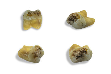 tooth with dental caries on white background