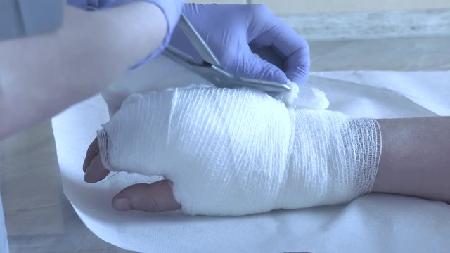 Nurse in the hospital treatment room, removes the bandages from the man's hand. Wound with blood in close-up , Dupuytren's contracture. Panning camera, Pan, Closeup