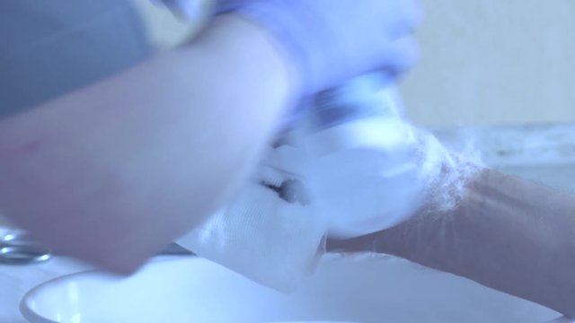 Nurse in the hospital treatment room, removes the bandages from the man's hand. Wound with blood in close-up , Dupuytren's contracture. Panning camera, Pan, Closeup