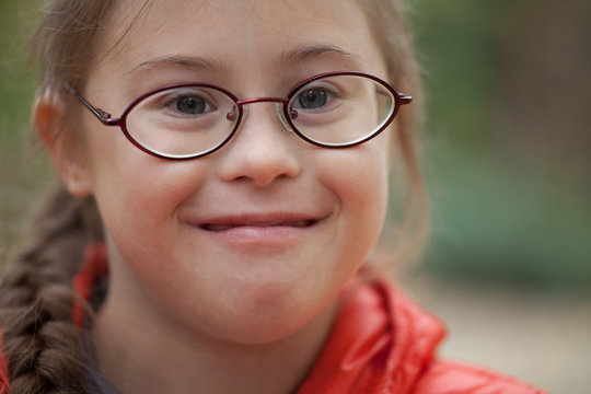 Portrait of a girl with special needs in glasses close-up