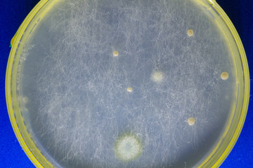 Growth of pathogenic bacteria populations populations from commercial toilet in petri dish