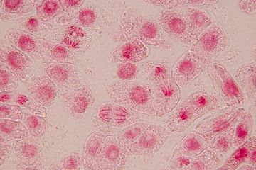 Root tip of Onion and Mitosis cell in the Root tip of Onion with dye extracts in glutinous rice under a microscope.