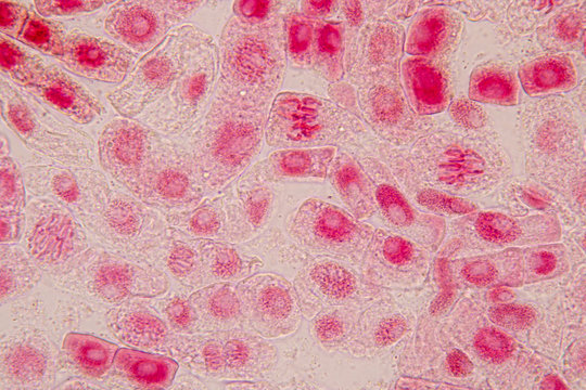 Root tip of Onion and Mitosis cell in the Root tip of Onion with dye extracts in glutinous rice under a microscope.