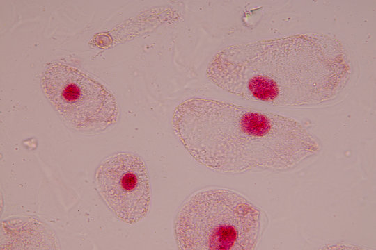 Root tip of Onion and Mitosis cell in the Root tip of Onion with dye extracts in glutinous rice under a microscope.