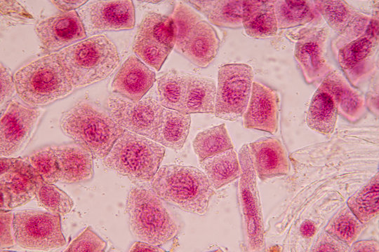 Root tip of Onion and Mitosis cell in the Root tip of Onion with dye extracts in glutinous rice under a microscope.
