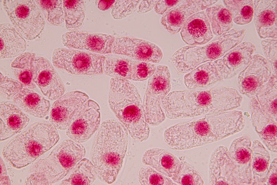 Root tip of Onion and Mitosis cell in the Root tip of Onion with dye extracts in glutinous rice under a microscope.