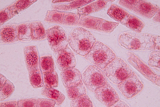 Root tip of Onion and Mitosis cell in the Root tip of Onion with dye extracts in glutinous rice under a microscope.