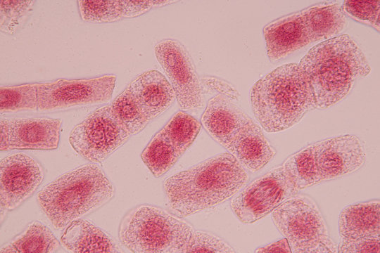 Root tip of Onion and Mitosis cell in the Root tip of Onion with dye extracts in glutinous rice under a microscope.