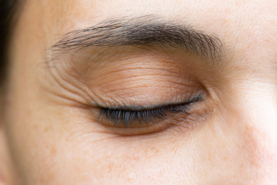 Wrinkles on close eye