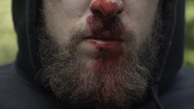Close portrait of unrecognizable man with beaten nose with blood at camera