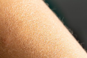 Macro image of dry skin