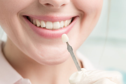 Bestimmung der Farbe für einen Zahnersatz am Mund