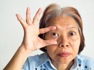 retirement elderly old ages asia women have eyes pain cataract lasik eyes surgery treatment flu fever dizzy dull stabbing headaches throbbing solutions problem systems
