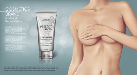 Web banner design of Stretch mark removal cream. Concept vector illustration of skin care and with woman with stretch marks on breast