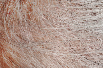 Capelli bianchi