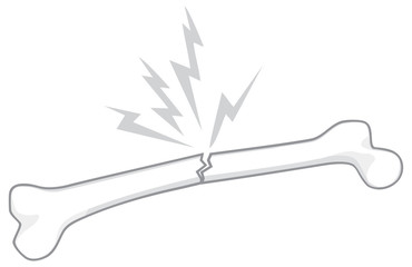 broken human bone vector illustration