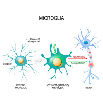 Activation of a microglial cell.