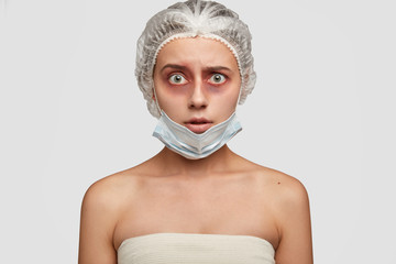 Stunned young woman being operated after concussion, stares at her face with bruises, wears medical...