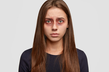 Sad European girl with bruises around eyes, being victim of aggressive man, cant escape from his power, dressed in casual clothes, stands against white background. Problems in family concept