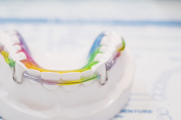Dental retainer orthodontic appliance on the colour background. - obrazy, fototapety, plakaty
