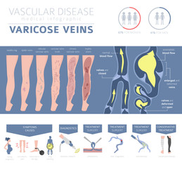 Vascular diseases. Varicose veins symptoms, treatment icon set. Medical infographic design