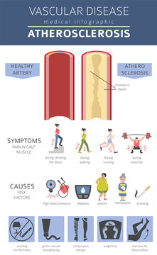 Vascular diseases. Atherosclerosis symptoms, treatment icon set. Medical infographic design