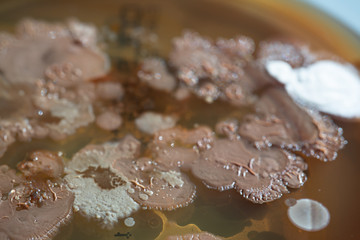 petri dish with various bacteria colonies on agar