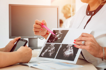 Doctor gynecologist consulting patient. Patient at doctor office. Diagnostic