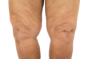 Naklejka premium Knees of senior woman isolated on white background