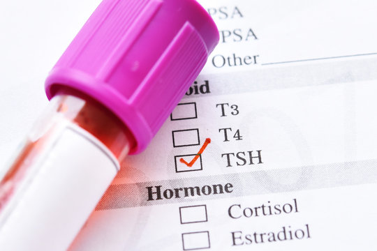 Blood sample tube with laboratory requisition form for thyroid stimulating hormone (TSH) test