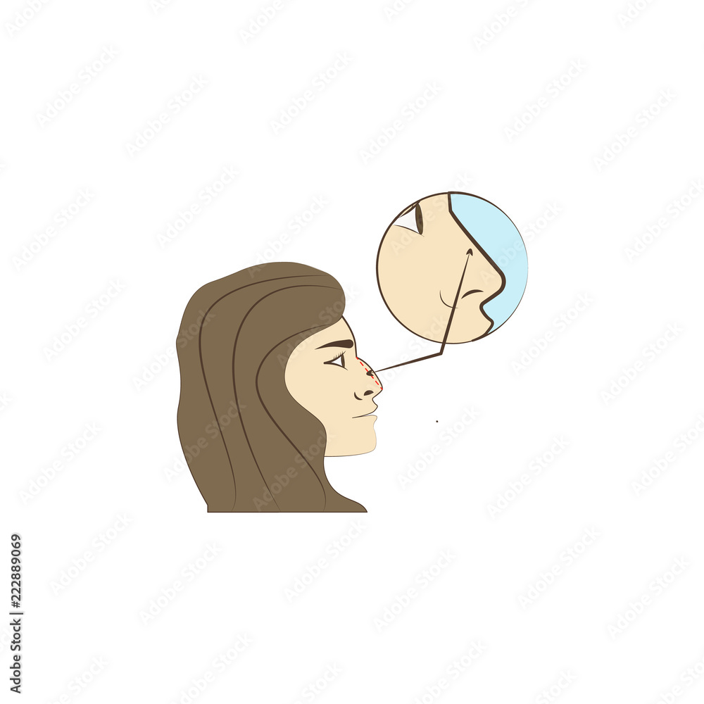 Poster surgery correcting nose colored icon. element of beauty and anti aging icon for mobile concept and w