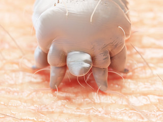 3d rendered medically accurate illustration of a scabies mite on human skin