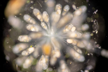 Rotifer under the microscope.