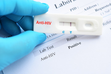 HIV positive test result by using rapid test cassette © jarun011
