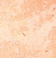 Fototapeta premium burned skin macro