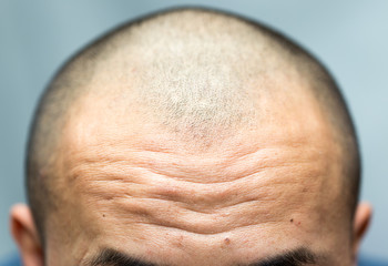 close-up on wrinkled forehead