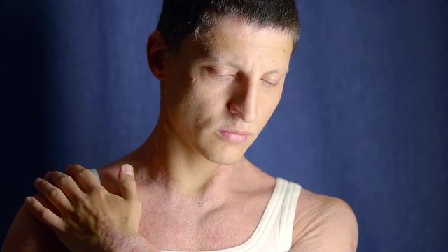 sad young man with psoriasis on his body is standing alone in dark studio, touching shoulder by hand