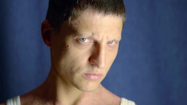 adult sorrowful man with dry and scaly skin with psoriasis is posing in blue wall background