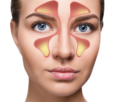 Rhinitis Bilder Durchsuchen 30,407 Archivfotos, und