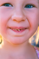 Fototapeta premium Portrait of a little girl with an outstretched milk tooth