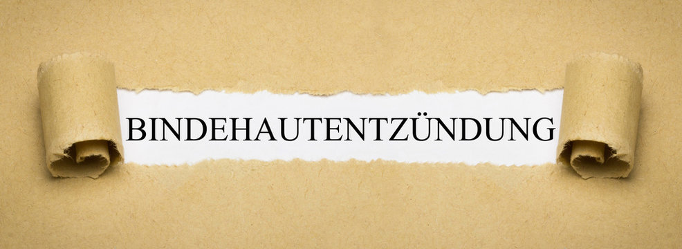Bindehautentz&uuml;ndung