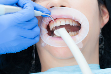 A woman in the dental hygienic and dental clinic professional teeth whitening and ultrasonic...