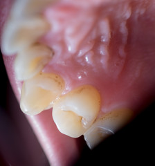 Human teeth macro