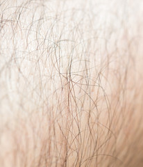 Hair on the body of the macro