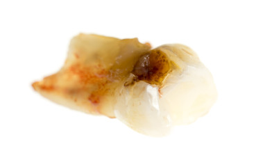 children's tooth on a white background