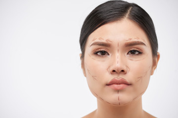 Face of beautiful young Vietnamese woman with lines for upcoming surgery