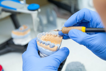 A dental technician dentist working with prostheses in a laboratory with wax on a jaw model