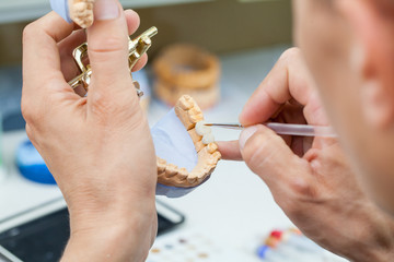 dental technician works by brush with jaw model