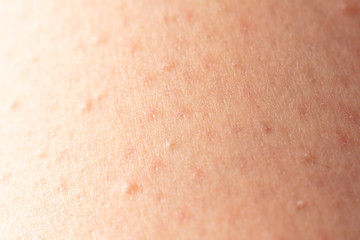 Fototapeta premium Girl's skin after depilation as a background
