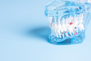 Dental model in oral health care concept.